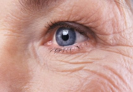 Macular Degeneration And Cataract Surgery:Compatible? | Griffin Eye ...